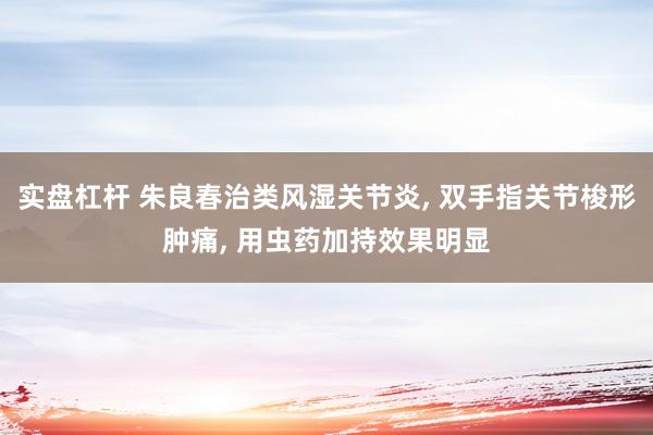 实盘杠杆 朱良春治类风湿关节炎, 双手指关节梭形肿痛, 用虫药加持效果明显